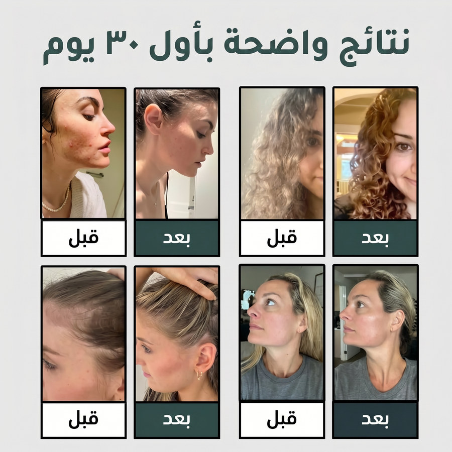 Muravai™ - راس الدوش بقوه ضغط عاليه مع فيلتر لتنقية المياه